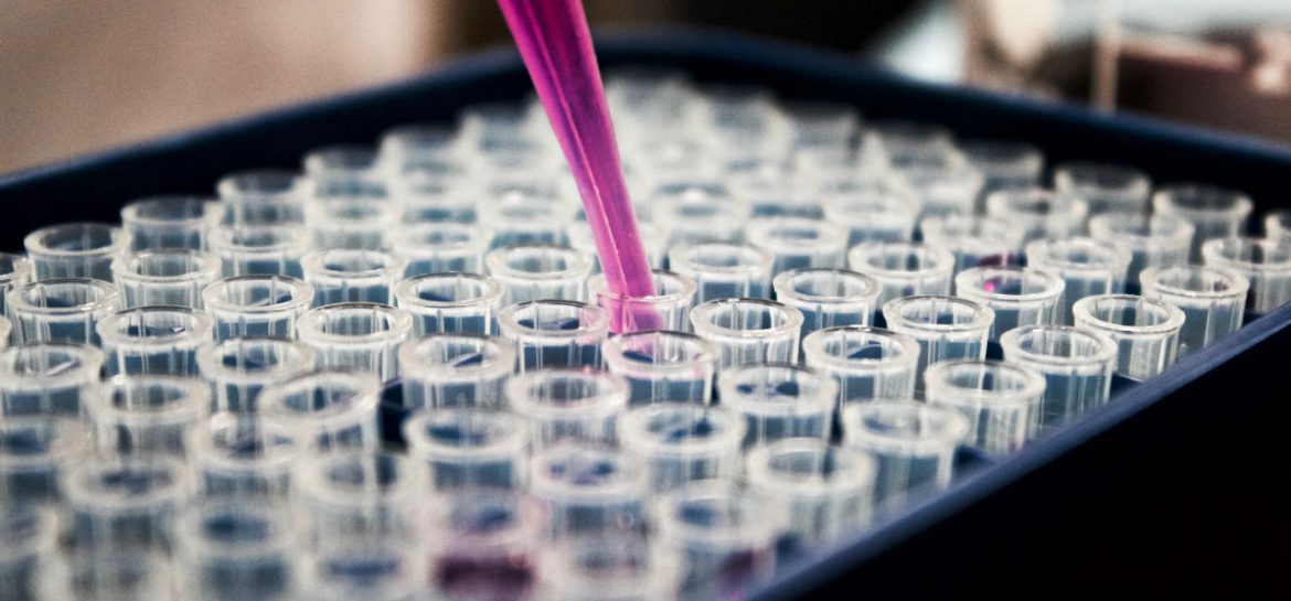 Vaderschapstest DNA-test
